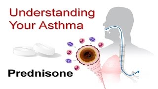 Understanding Your Asthma Part 5 Prednisone [upl. by Ferde717]