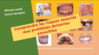 Risques de santé et protheses amovibles dentaires  health risks of Removables dentures prothesis [upl. by Attevad]